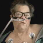 一个女人看着相机，用鼻子呼吸管，ekg电线贴在胸前。