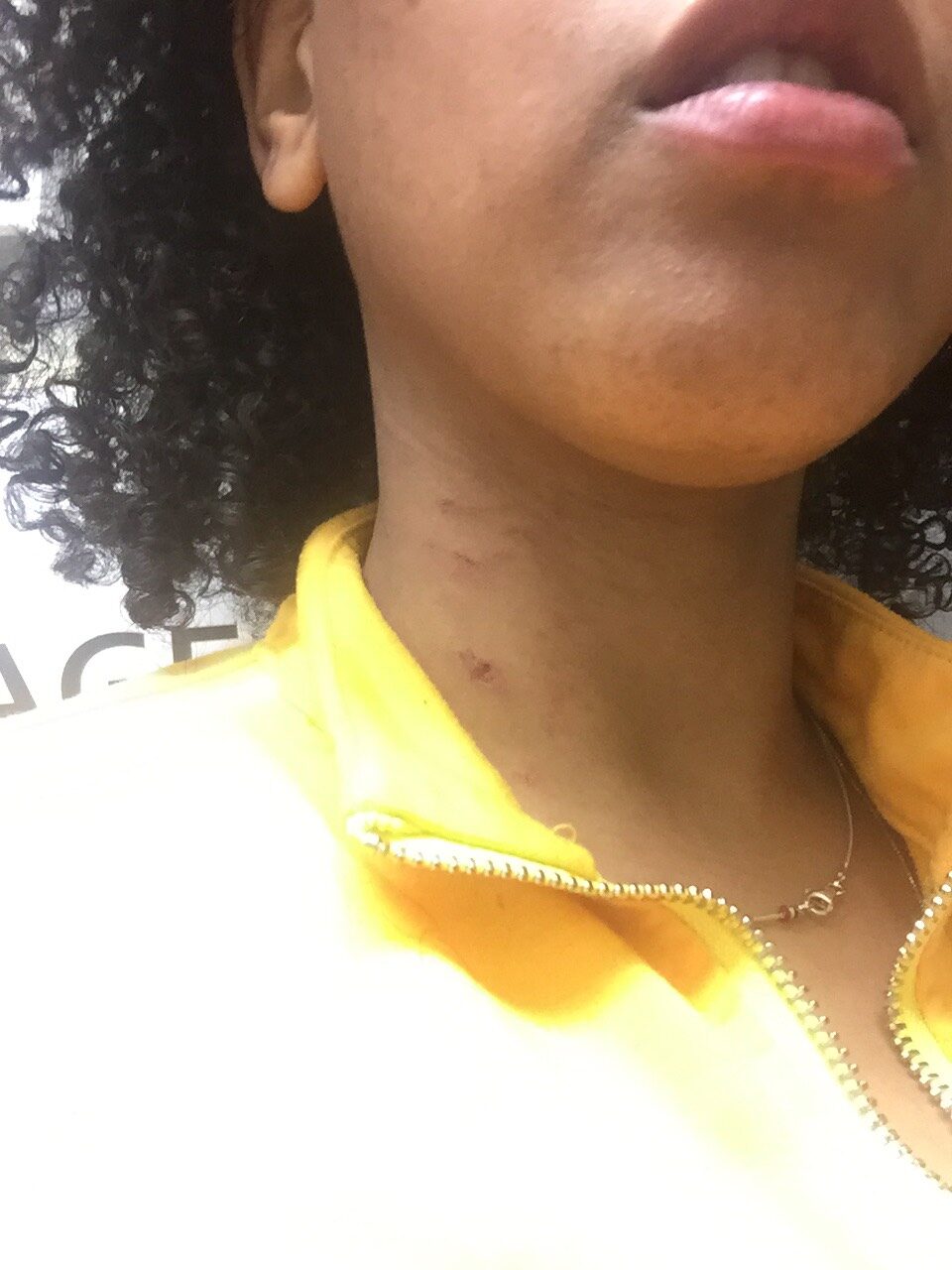 在黄衬衫的脖子上划痕的划痕