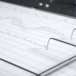 由多指生产的锯齿状的线的特写镜头