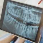 a dental x ray